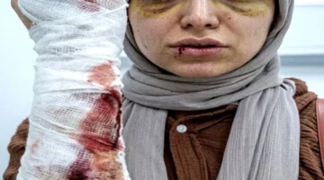 تجديد حبس شقيق مريضة اعتدى على طبيبة داخل مستشفى في شبرا الخيمة